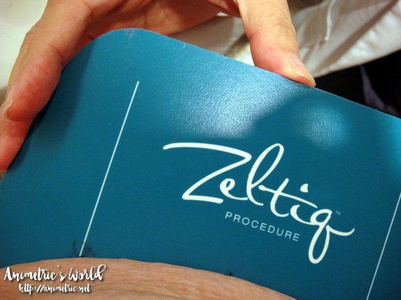 Marie France CoolSculpting