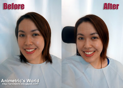 Before and after Shiseido White Lucent