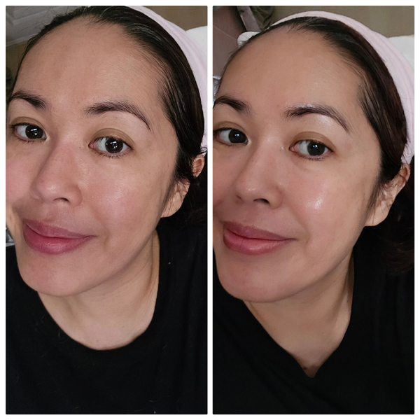 Before and After Riman